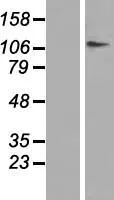 DPYD (NM_000110) Human Over-expression Lysate - image 1