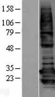 BAP31 (BCAP31) (NM_001139441) Human Over-expression Lysate - image 1