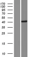 CCDC113 (NM_001142302) Human Over-expression Lysate - image 1
