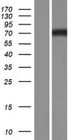 Nephronophthisis (NPHP1) (NM_001128179) Human Over-expression Lysate - image 1