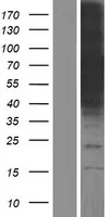 CoCoA (CALCOCO1) (NM_001143682) Human Over-expression Lysate - image 1