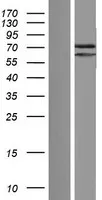 PATL2 (NM_001145112) Human Over-expression Lysate - image 1