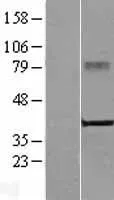 DENND2B (NM_005418) Human Over-expression Lysate - image 1