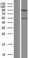 TCP1 eta (CCT7) (NM_001166284) Human Over-expression Lysate - image 1