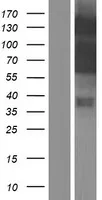 Myocardin (MYOCD) (NM_001146313) Human Over-expression Lysate - image 1