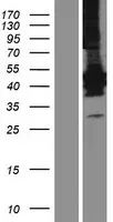 Lunatic Fringe (LFNG) (NM_001166355) Human Over-expression Lysate - image 1