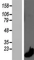 Calprotectin (S100a8) (NM_013650) Mouse Over-expression Lysate - image 1