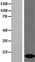 Hbb-bt (NM_008220) Mouse Over-expression Lysate - image 1