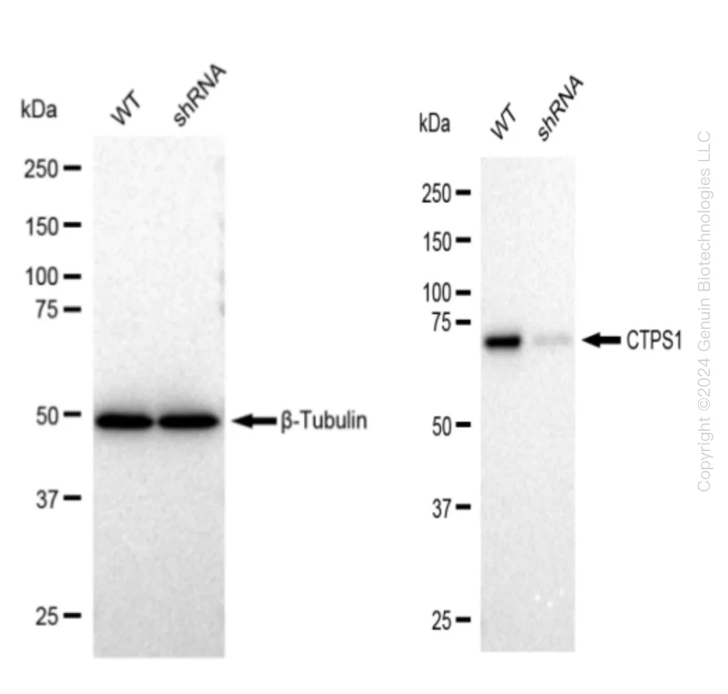 CTP synthase (CTPS1) Human Knockdown Lysate - image 1
