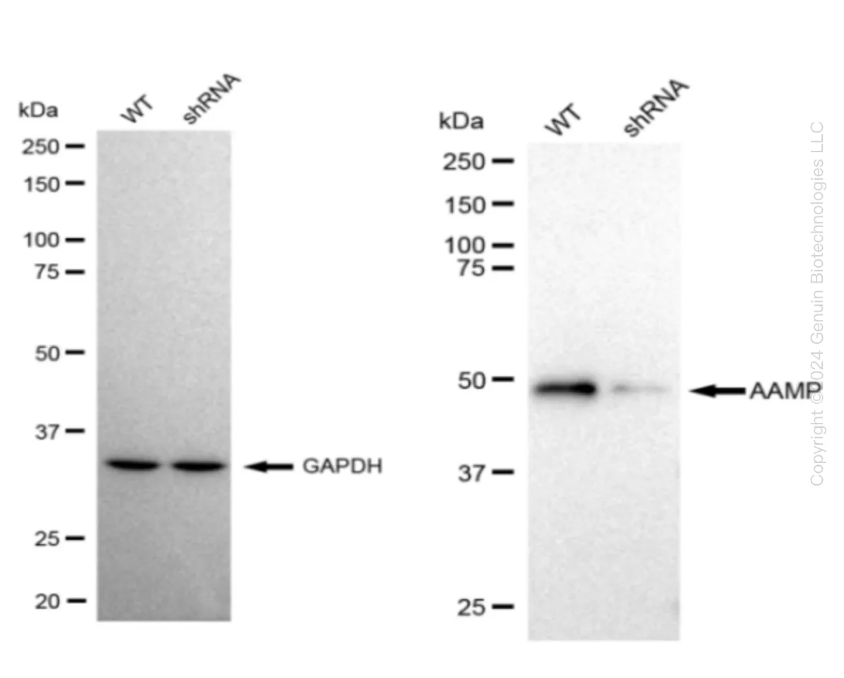 AAMP Human Knockdown Lysate - image 1