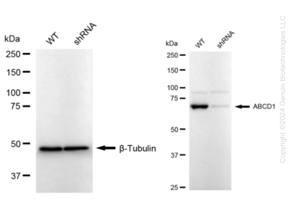 ABCD1 Human Knockdown Lysate - image 1