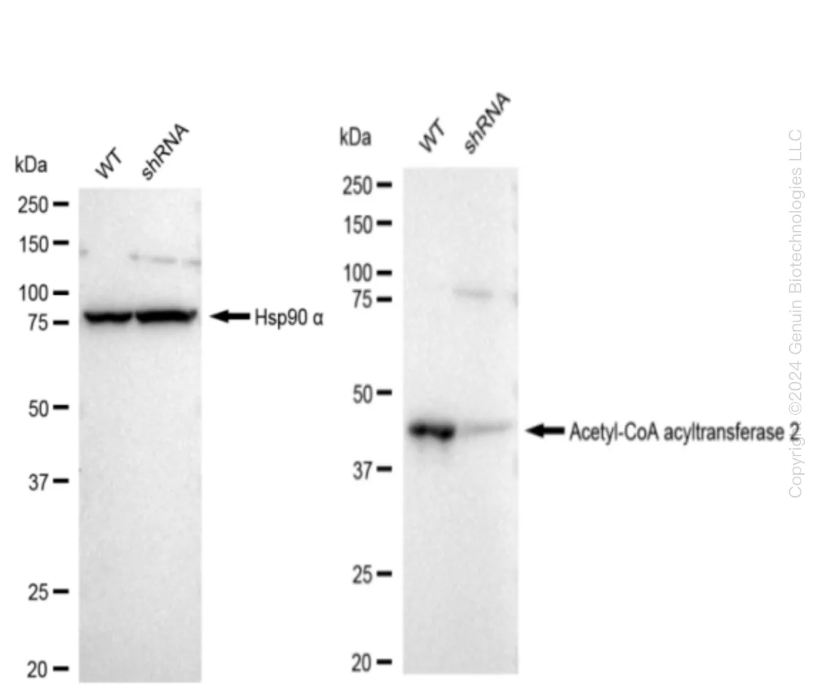 ACAA2 Human Knockdown Lysate - image 1