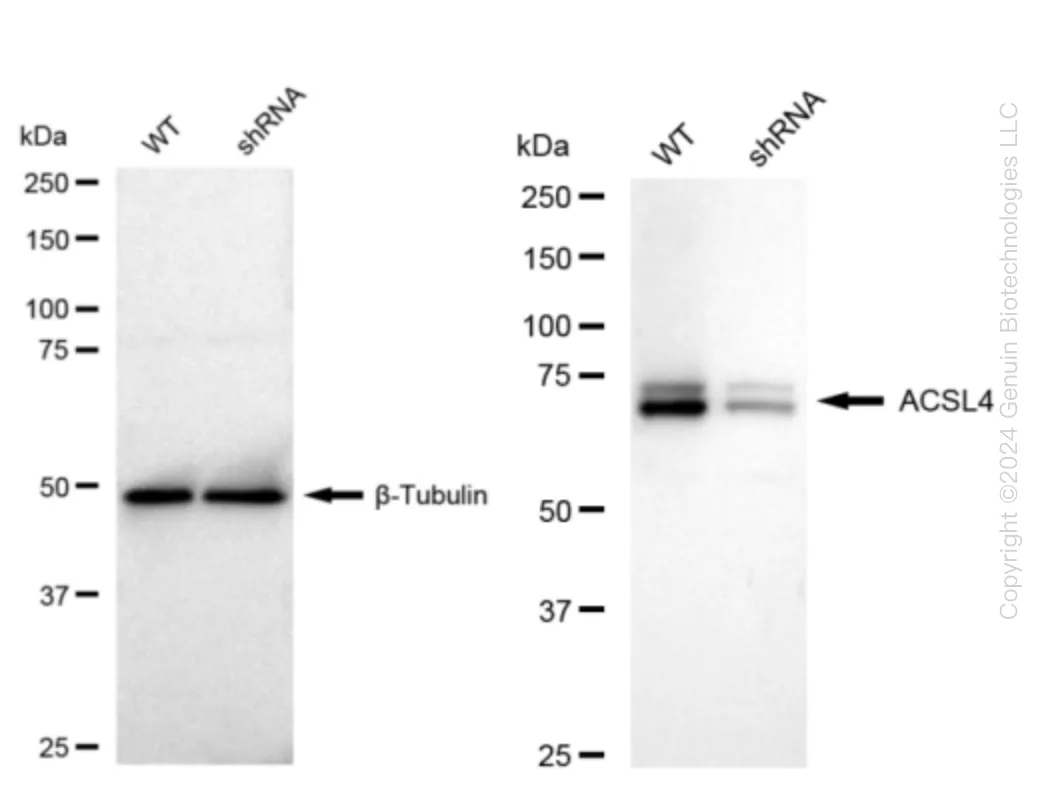 FACL4 (ACSL4) Human Knockdown Lysate - image 1