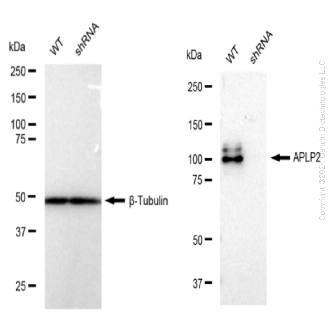 APLP2 Human Knockdown Lysate - image 1