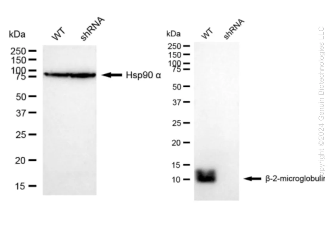 beta 2 Microglobulin (B2M) Human Knockdown Lysate - image 1