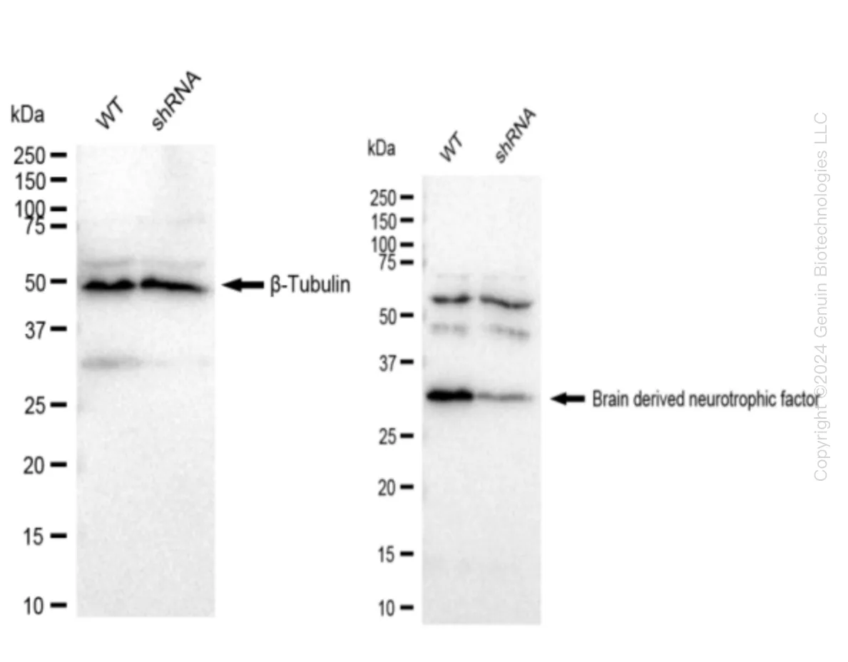 BDNF Human Knockdown Lysate - image 1