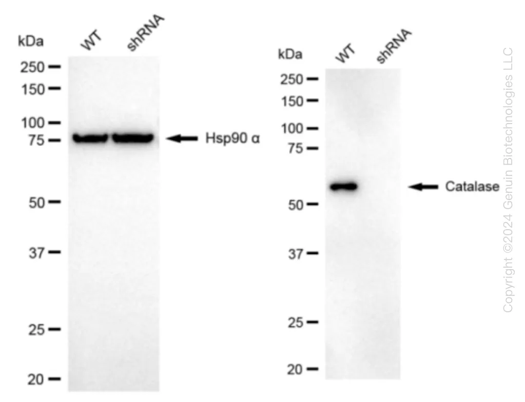 Catalase (CAT) Human Knockdown Lysate - image 1