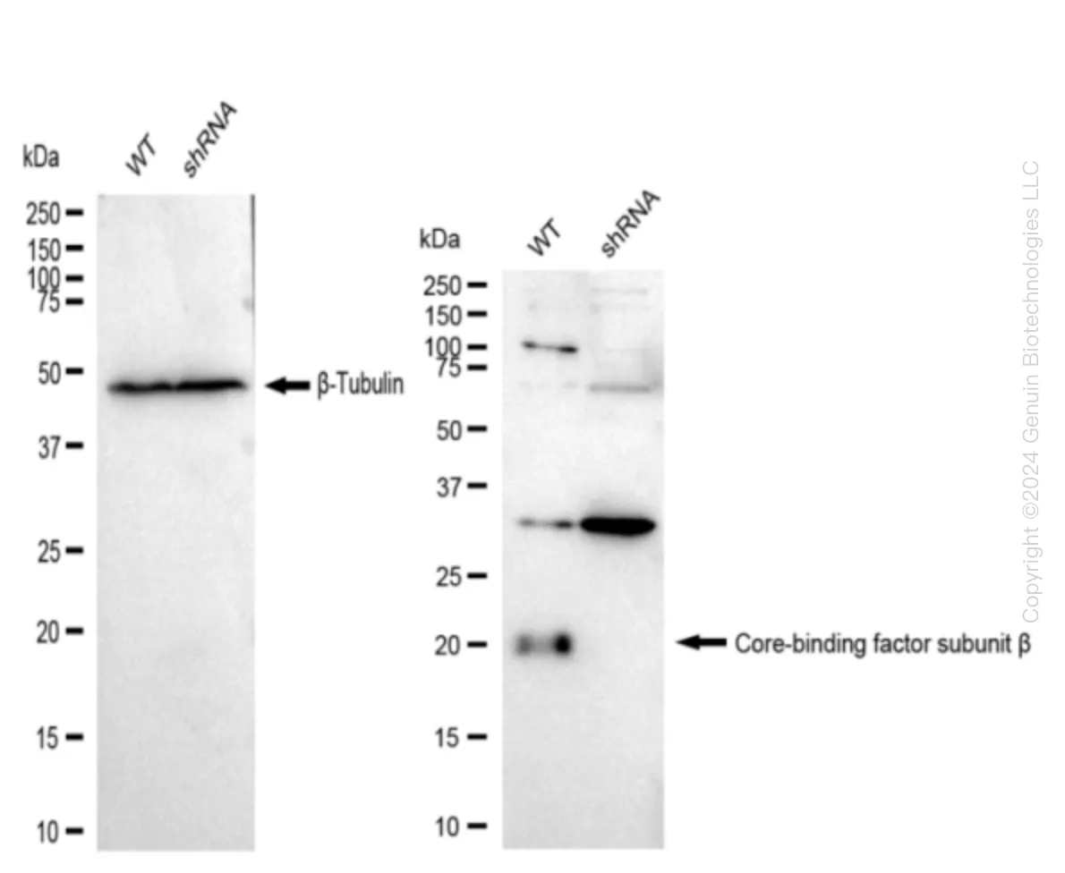 CBFB Human Knockdown Lysate - image 1