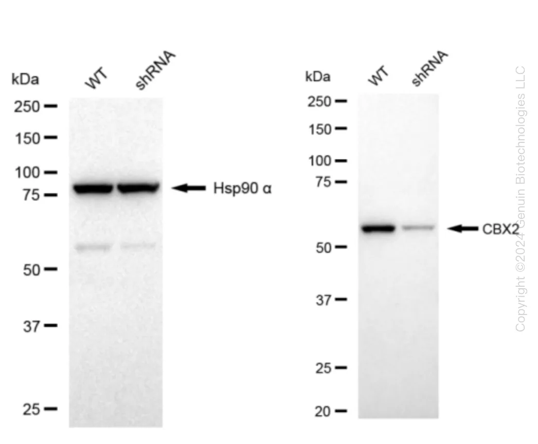CBX2 Human Knockdown Lysate - image 1