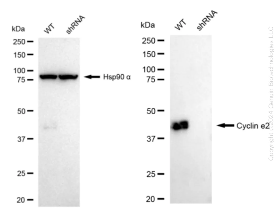 Cyclin E2 (CCNE2) Human Knockdown Lysate - image 1