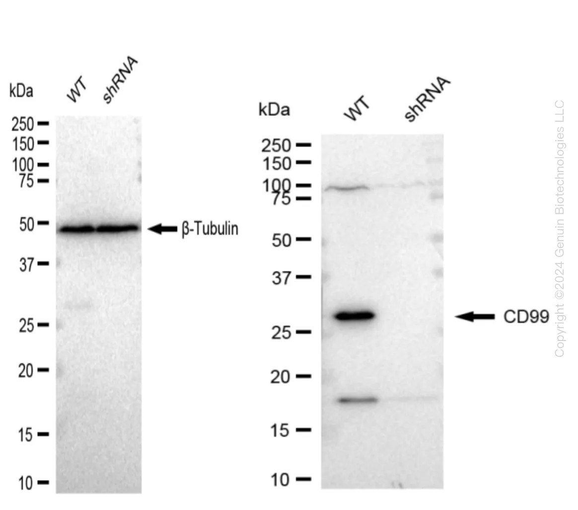 CD99 Human Knockdown Lysate - image 1