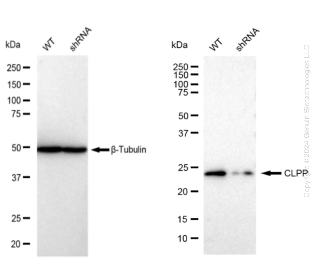 CLPP Human Knockdown Lysate - image 1