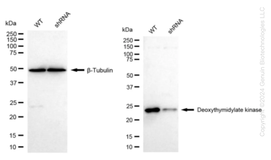 DTYMK Human Knockdown Lysate - image 1