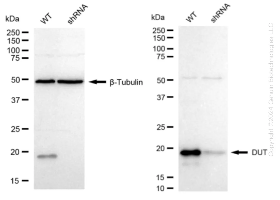 DUT Human Knockdown Lysate - image 1