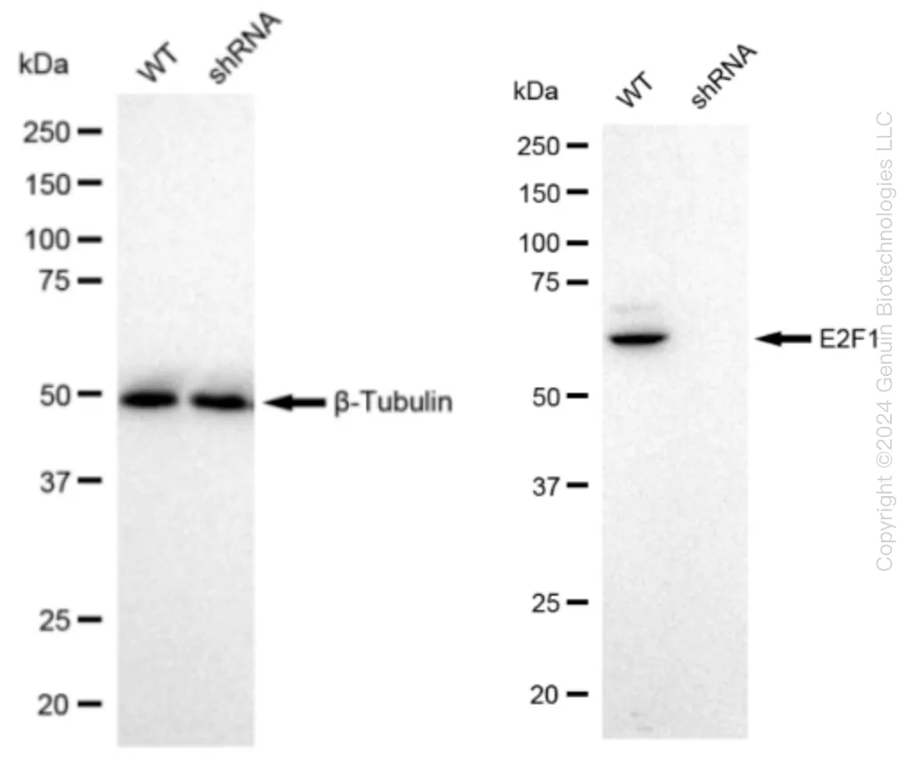 E2F1 Human Knockdown Lysate - image 1