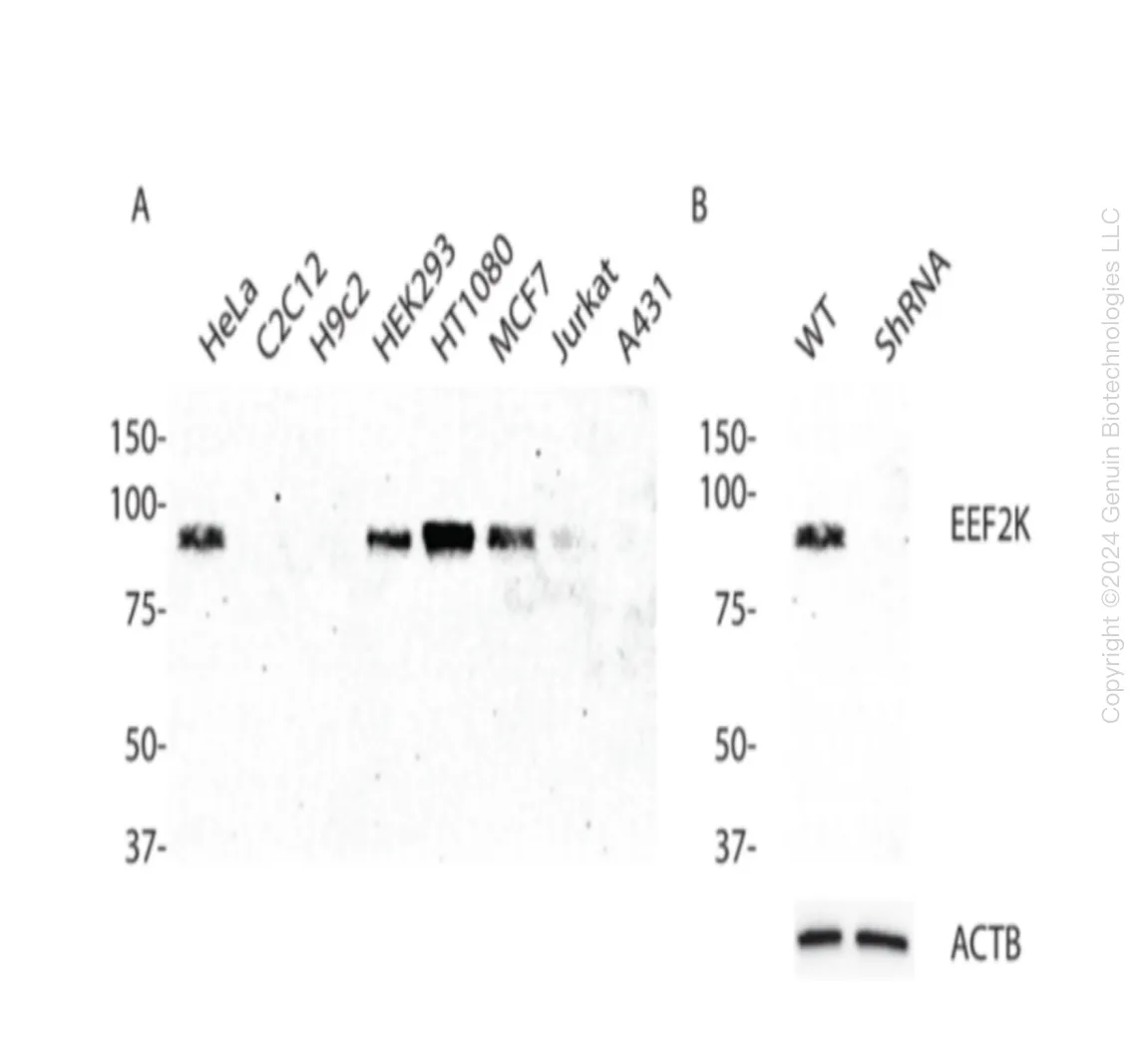 EEF2K Human Knockdown Lysate - image 1