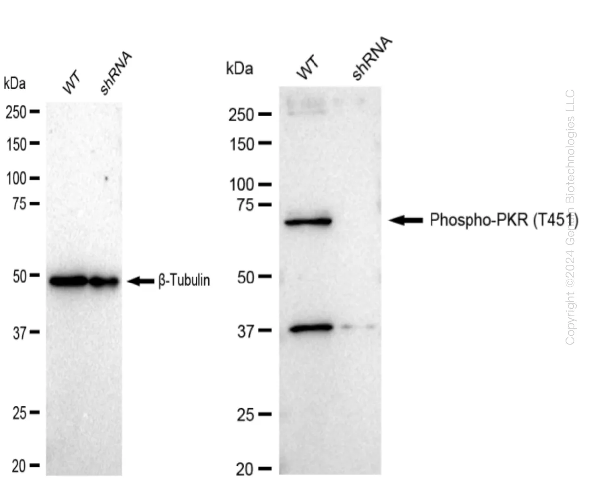 PKR (EIF2AK2) Human Knockdown Lysate - image 1