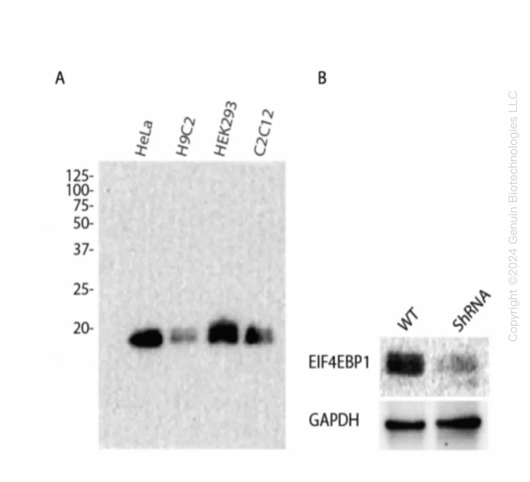 EIF4EBP1 Human Knockdown Lysate - image 1