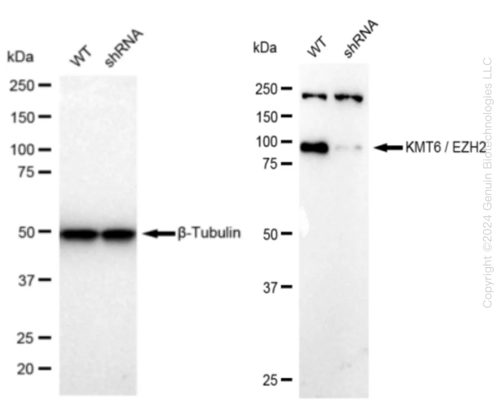 EZH2 Human Knockdown Lysate - image 1