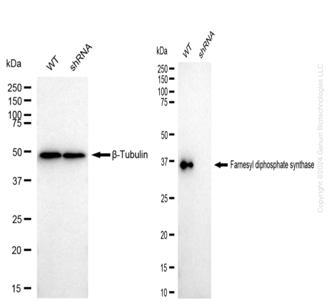 FDPS Human Knockdown Lysate - image 1