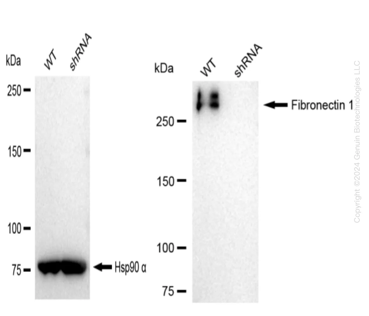 Fibronectin (FN1) Human Knockdown Lysate - image 1