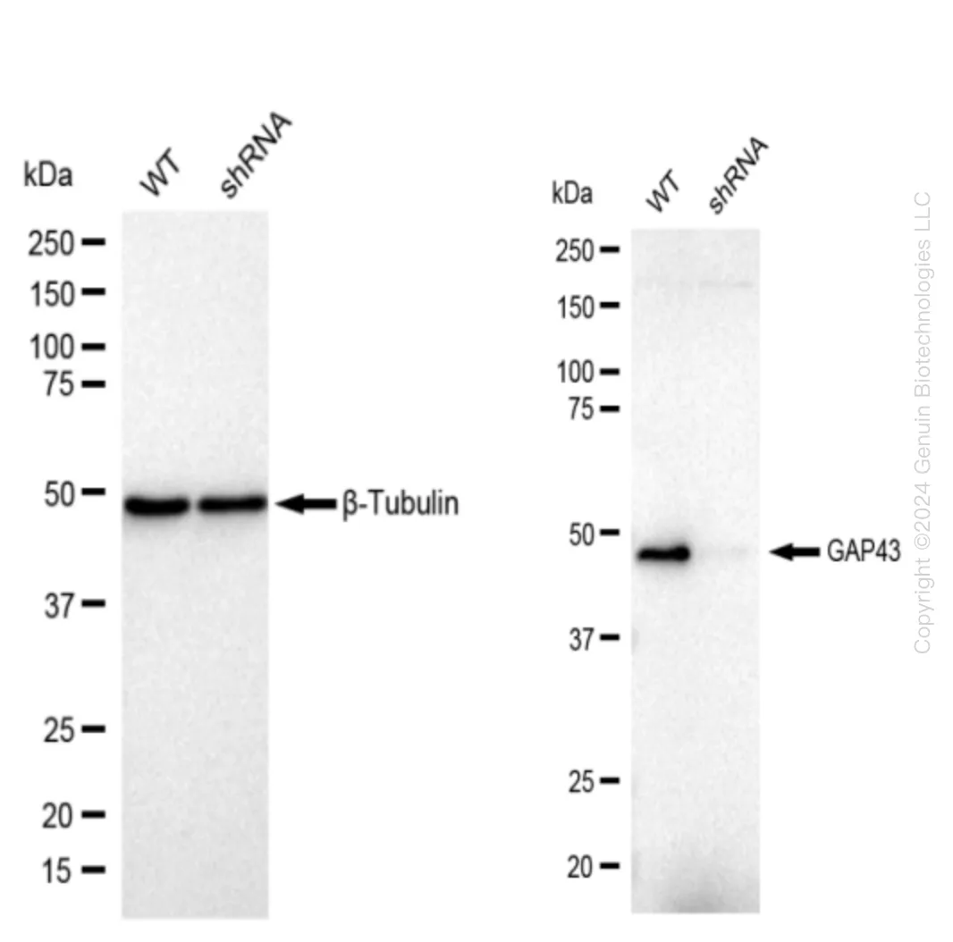 GAP43 Human Knockdown Lysate - image 1