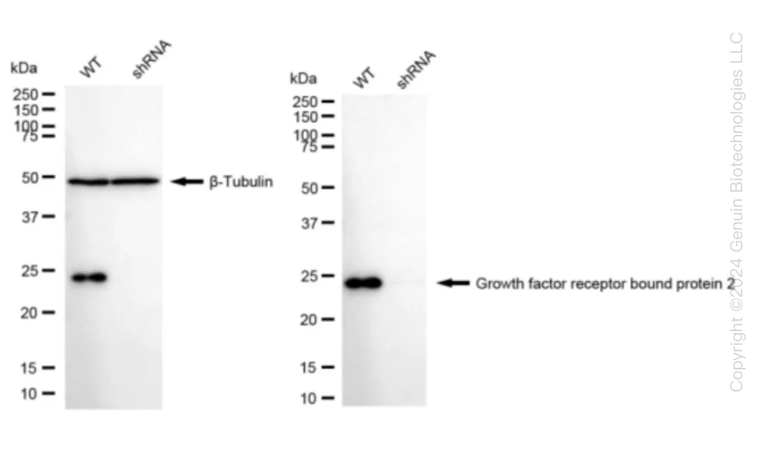 GRB2 Human Knockdown Lysate - image 1