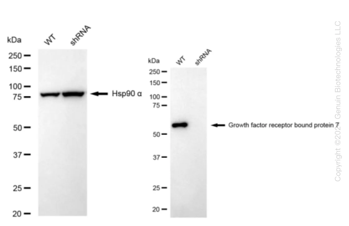 GRB7 Human Knockdown Lysate - image 1