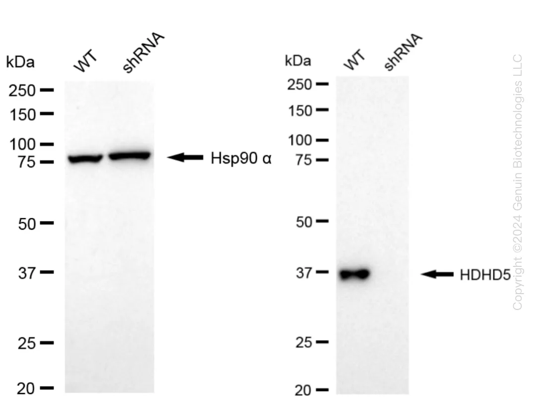 HDHD5 Human Knockdown Lysate - image 1