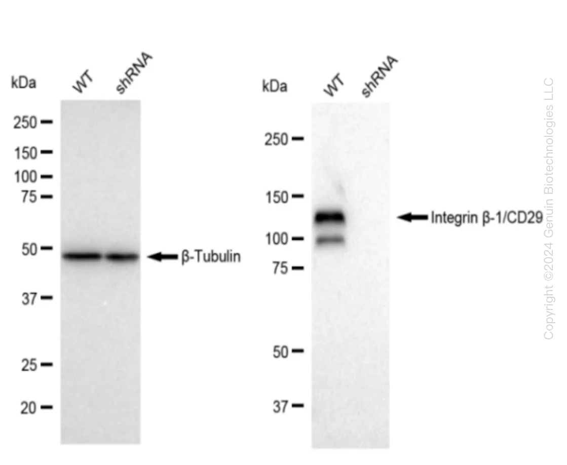 Integrin beta 1 (ITGB1) Human Knockdown Lysate - image 1