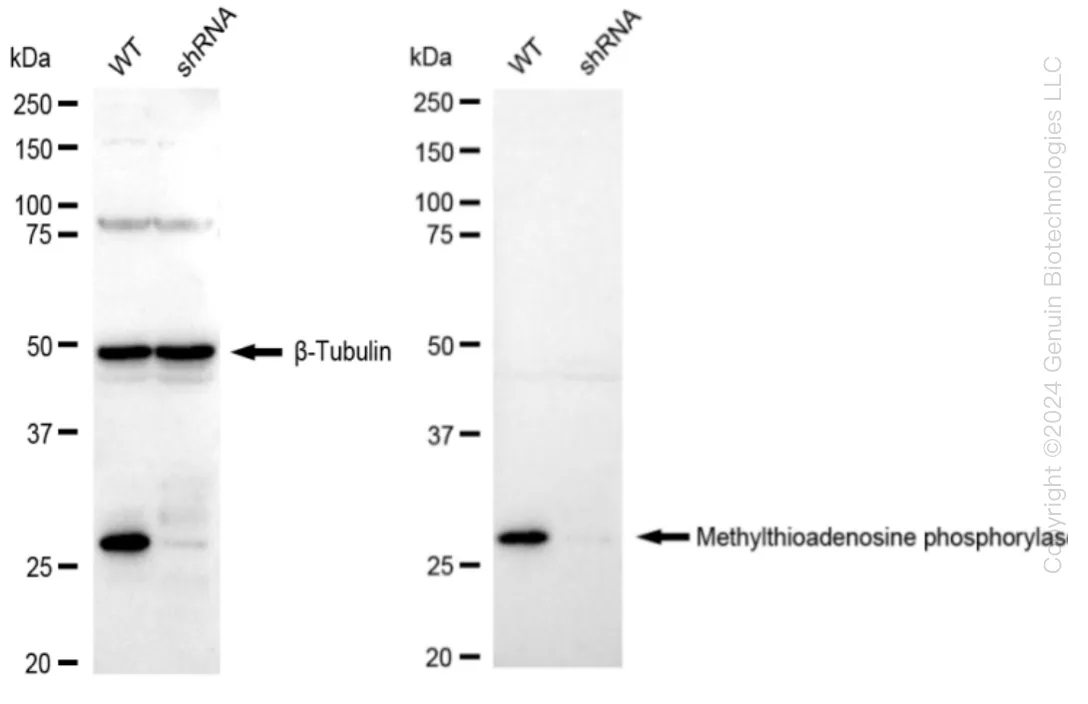 MTAP Human Knockdown Lysate - image 1