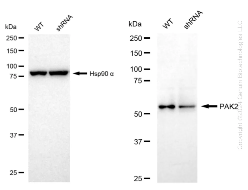 PAK2 Human Knockdown Lysate - image 1