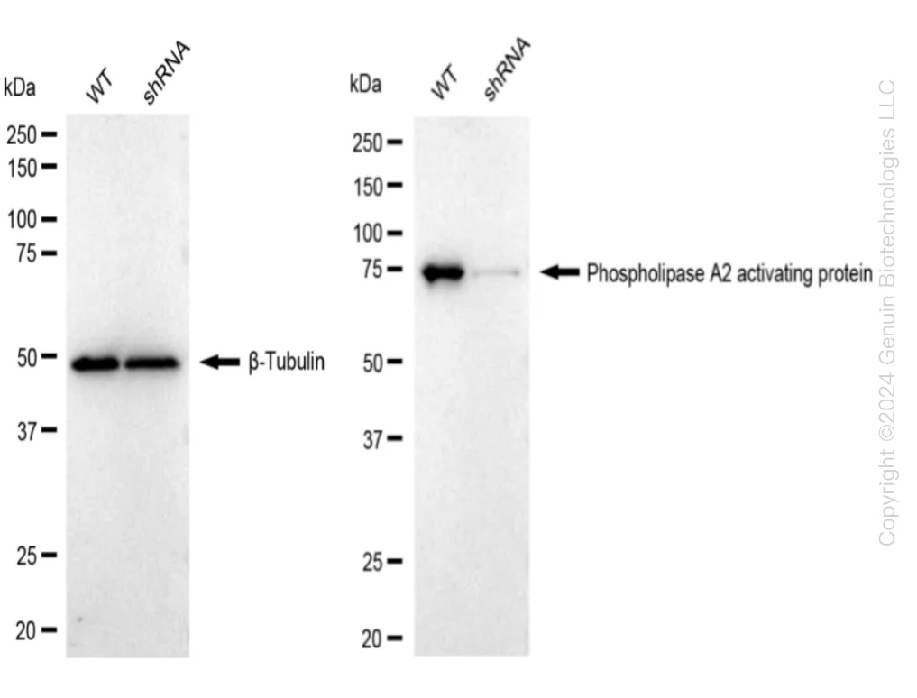 PLAA Human Knockdown Lysate - image 1