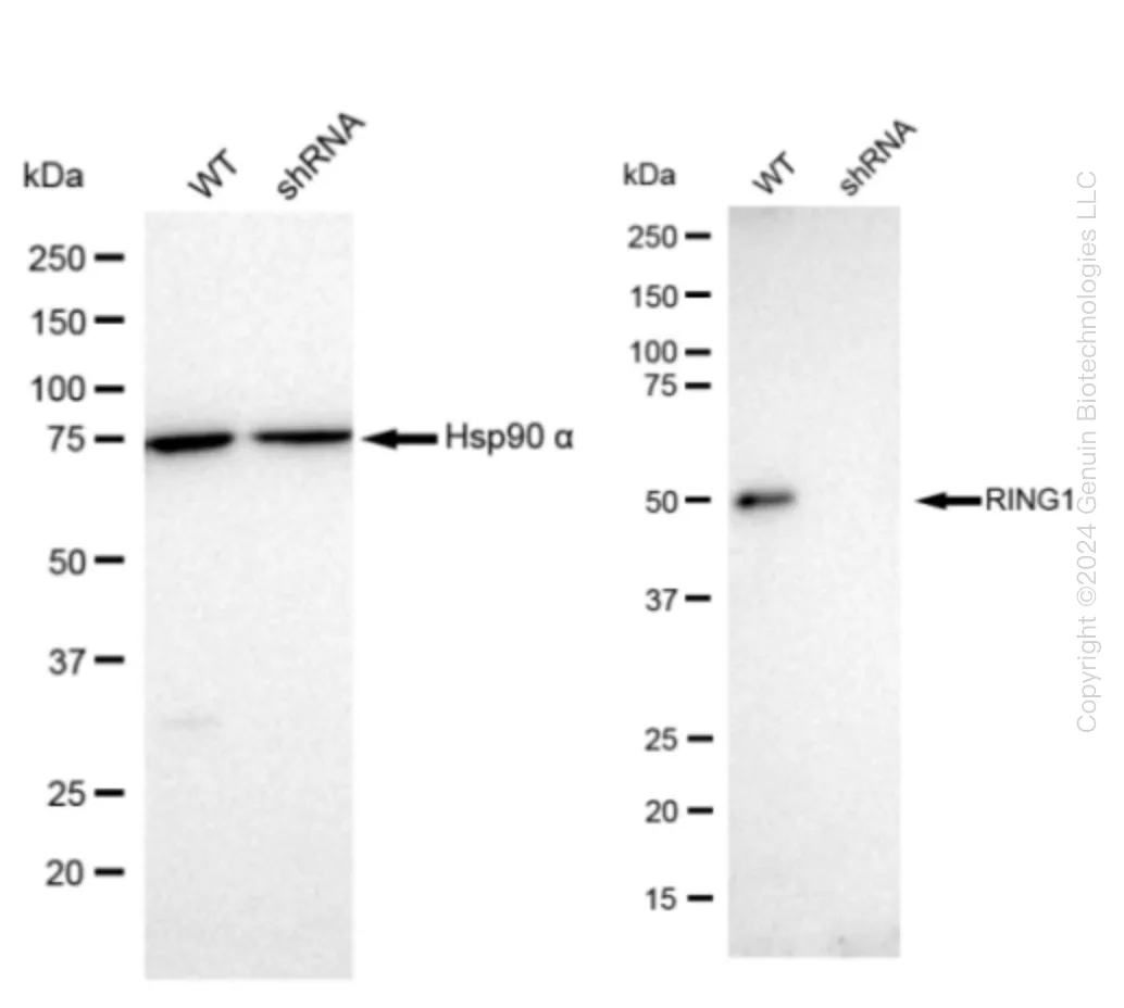 RING1 Human Knockdown Lysate - image 1