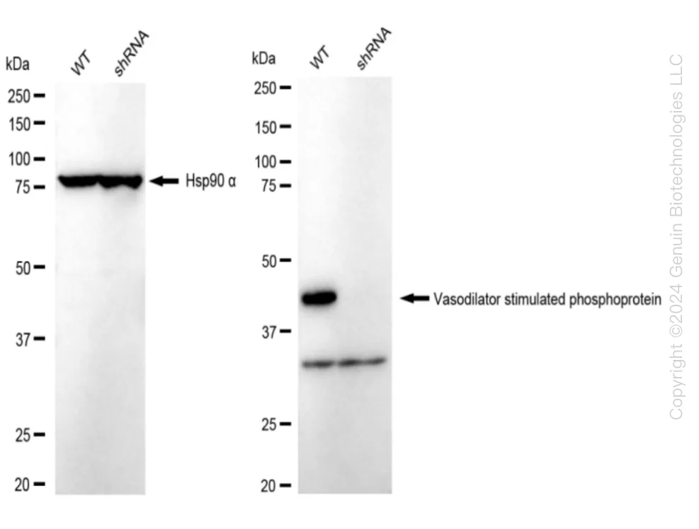 VASP Human Knockdown Lysate - image 1