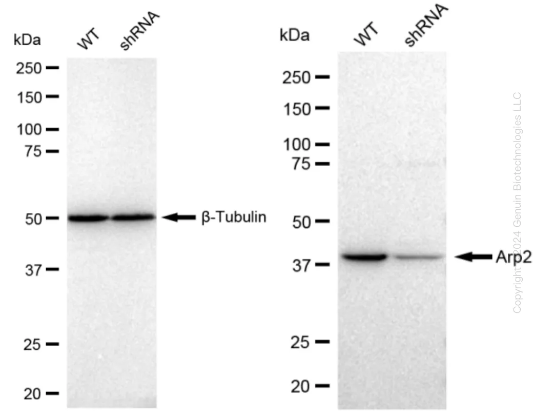 Arp2 (ACTR2) Human Knockdown Lysate - image 1
