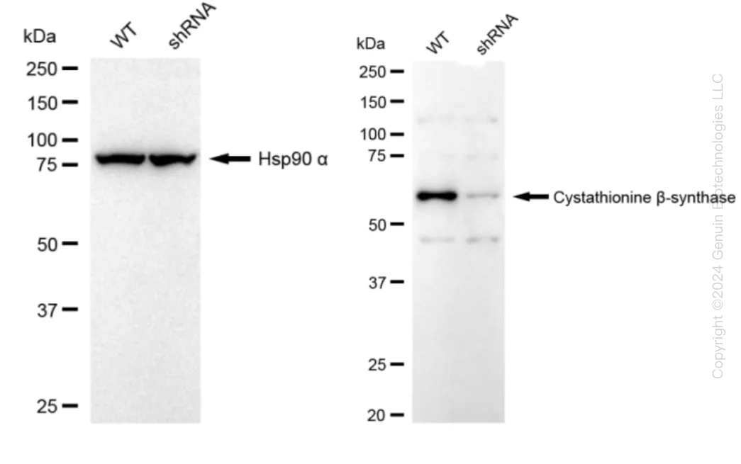 CBS Human Knockdown Lysate - image 1