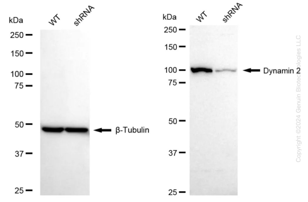 Dynamin 2 (DNM2) Human Knockdown Lysate - image 1