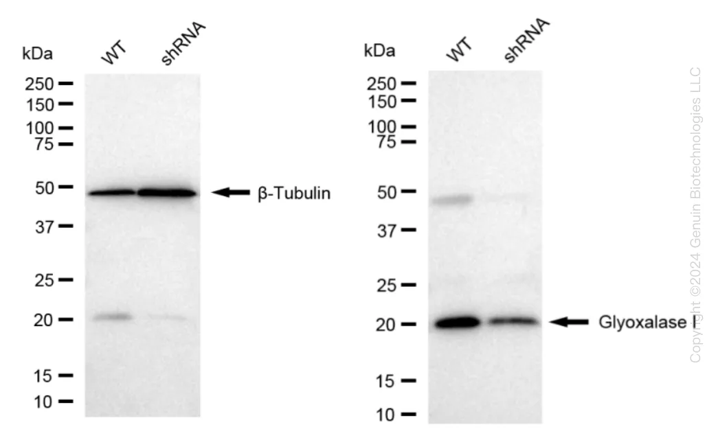 GLO1 Human Knockdown Lysate - image 1