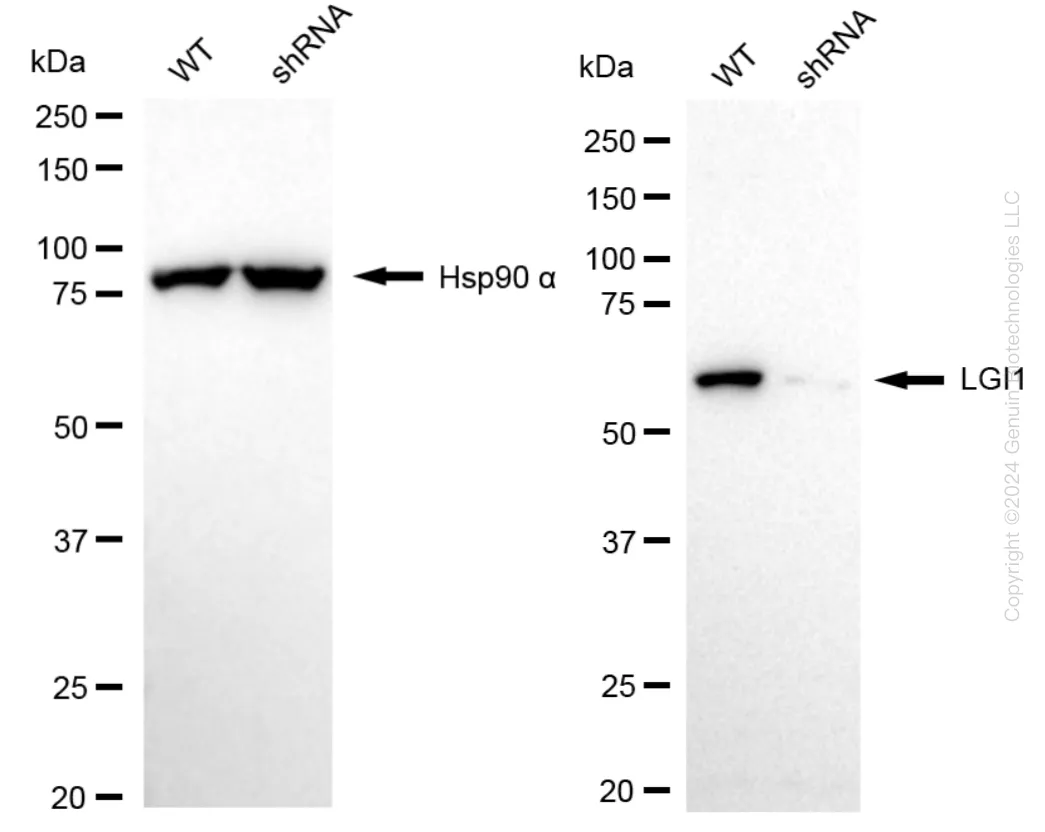 LGI1 Human Knockdown Lysate - image 1